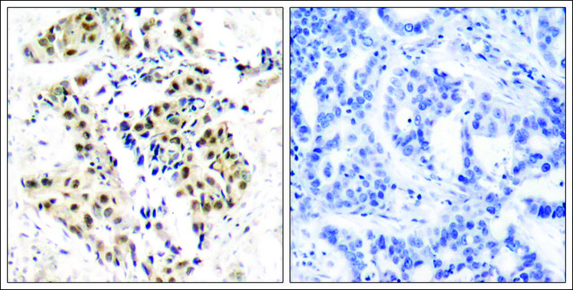 Anti-phospho-ATM (pSer1981) antibody produced in rabbit affinity isolated antibody