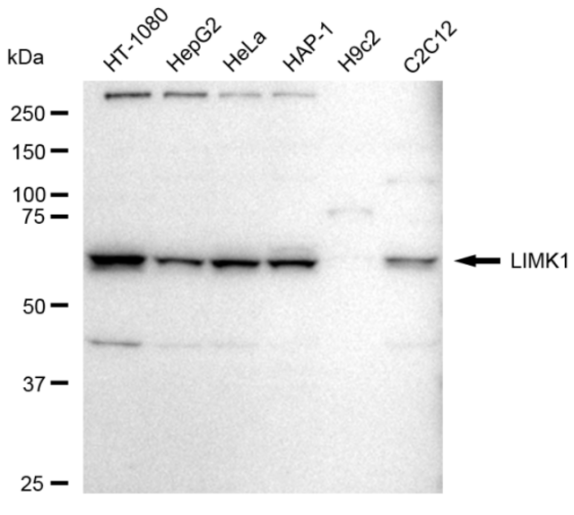 Anti LIMK1 Antibody, clone 23GB6425, Rabbit Monoclonal clone 23GB6425, recombinant rabbit monoclonal, expressed in HEK293 cells