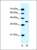 Anti-GOT2 (AB2) antibody produced in rabbit IgG fraction of antiserum