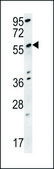 ANTI-SPATA18 (N-TERM) antibody produced in rabbit IgG fraction of antiserum, buffered aqueous solution