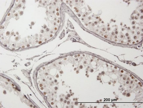 Anti-ING4 antibody produced in mouse IgG fraction of antiserum, buffered aqueous solution