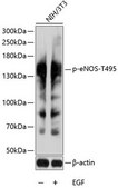 Anti-Phospho-eNOS-T495 antibody produced in rabbit