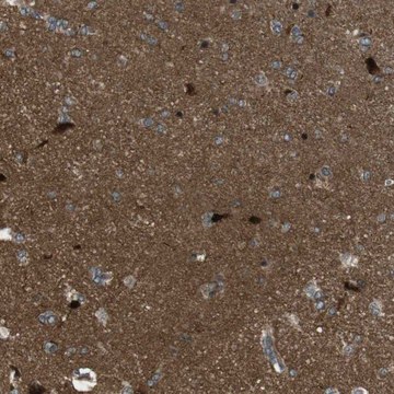 Anti-TIAM2 antibody produced in rabbit Prestige Antibodies&#174; Powered by Atlas Antibodies, affinity isolated antibody, buffered aqueous glycerol solution