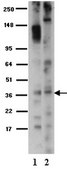 Anti-Opioid Receptor Antibody, &#181;, pain serum, Chemicon&#174;