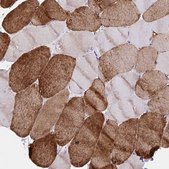 Anti-ATP2A2 antibody produced in rabbit Prestige Antibodies&#174; Powered by Atlas Antibodies, affinity isolated antibody, buffered aqueous glycerol solution