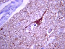 Anti-Tau phospho Threonine 231 Antibody Chemicon&#174;, from rabbit