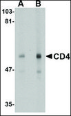 Monoclonal Anti-CD4L antibody produced in mouse clone 9H5A8, purified immunoglobulin, buffered aqueous solution
