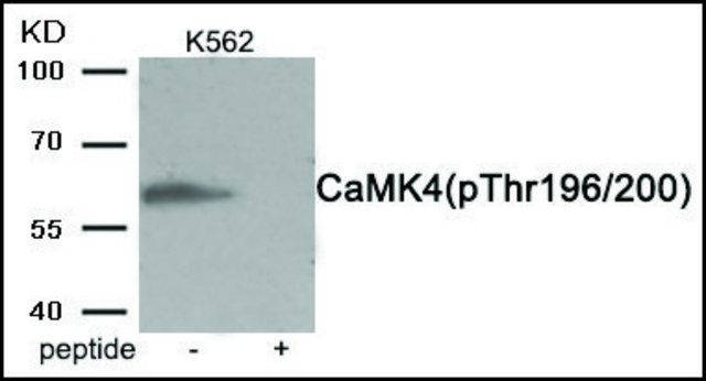 Anti-phospho-CaMK4 (pThr196/200) antibody produced in rabbit affinity isolated antibody