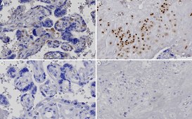 Anti-p57Kip2 Antibody, clone 1H11 ZooMAb® Rabbit Monoclonal recombinant, expressed in HEK 293 cells