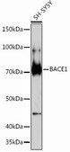 Anti-BACE1 Antibody, clone 7C5T7, Rabbit Monoclonal