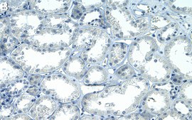 Anti-TXNIP Antibody, clone 1K14 ZooMAb&#174; Rabbit Monoclonal recombinant, expressed in HEK 293 cells