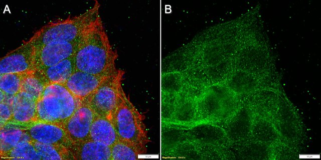 Anti-ApoE Antibody, clone 3N14 ZooMAb&#174; Rabbit Monoclonal recombinant, expressed in HEK 293 cells