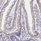 Anti-IDH3G antibody produced in rabbit Ab1, Prestige Antibodies&#174; Powered by Atlas Antibodies, affinity isolated antibody, buffered aqueous glycerol solution