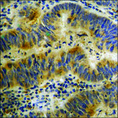 Anti-phospho-ATP-Citrate Lyase (pSer454) antibody produced in rabbit affinity isolated antibody