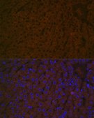 Anti-Haptoglobin (HP) antibody produced in rabbit