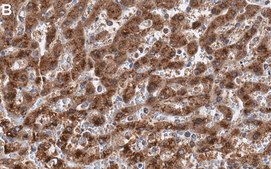 Anti-Catalase Antibody, clone 1C21 ZooMAb&#174; Rabbit Monoclonal recombinant, expressed in HEK 293 cells