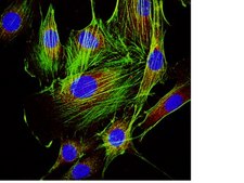 Anti-p120 Catenin Antibody, clone 15D2 clone 15D2, from mouse