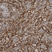 Anti-HLA-E antibody produced in rabbit Prestige Antibodies&#174; Powered by Atlas Antibodies, affinity isolated antibody, buffered aqueous glycerol solution