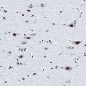 Anti-TOP1 antibody produced in rabbit Prestige Antibodies&#174; Powered by Atlas Antibodies, affinity isolated antibody, buffered aqueous glycerol solution
