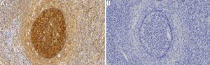 Anti-AMH/MIS Antibody, clone 2G11 ZooMAb&#174; Rabbit Monoclonal recombinant, expressed in HEK 293 cells
