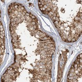 Anti-CAPZB antibody produced in rabbit Prestige Antibodies&#174; Powered by Atlas Antibodies, affinity isolated antibody, buffered aqueous glycerol solution