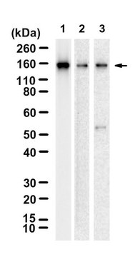Anti-CDKL5 Antibody, clone 2J15 ZooMAb&#174; Rabbit Monoclonal recombinant, expressed in HEK 293 cells