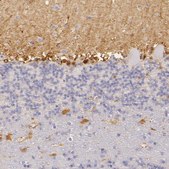 Anti-CBS antibody produced in rabbit Prestige Antibodies&#174; Powered by Atlas Antibodies, affinity isolated antibody, buffered aqueous glycerol solution