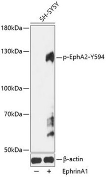 Anti-Phospho-EphA2-Y594 antibody produced in rabbit