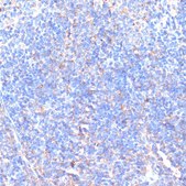 Anti-MMP9 antibody produced in rabbit