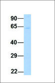 Anti-YTHDF3 (ab1) antibody produced in rabbit affinity isolated antibody