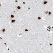 Anti-SF3A1 antibody produced in rabbit Prestige Antibodies&#174; Powered by Atlas Antibodies, affinity isolated antibody, buffered aqueous glycerol solution