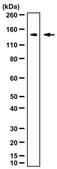 Anti-TRPM4 Antibody from rabbit, purified by affinity chromatography