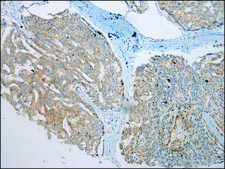 Anti-VPS4A affinity isolated antibody