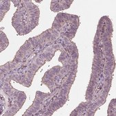 Anti-TXNIP antibody produced in rabbit Prestige Antibodies&#174; Powered by Atlas Antibodies, affinity isolated antibody, buffered aqueous glycerol solution