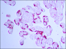 Anti-Transglutaminase-2 (C-terminal) antibody produced in rabbit ~1.5&#160;mg/mL, affinity isolated antibody