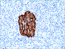Anti-Chromogranin A antibody, Rabbit monoclonal recombinant, expressed in HEK 293 cells, clone RM385, purified immunoglobulin