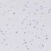 Anti-P2RY8 antibody produced in rabbit Prestige Antibodies® Powered by Atlas Antibodies, affinity isolated antibody, buffered aqueous glycerol solution