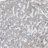 Anti-ALPL antibody produced in rabbit Ab1, Prestige Antibodies® Powered by Atlas Antibodies, affinity isolated antibody, buffered aqueous glycerol solution