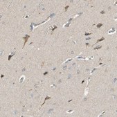 Anti-CDH6 antibody produced in rabbit Ab2, Prestige Antibodies&#174; Powered by Atlas Antibodies, affinity isolated antibody, buffered aqueous glycerol solution