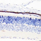 Anti-RPA70 antibody produced in rabbit