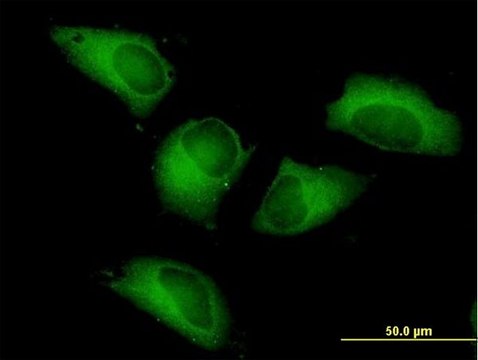 Anti-PFKP antibody produced in mouse IgG fraction of antiserum, buffered aqueous solution