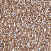 Anti-PHB antibody produced in rabbit Prestige Antibodies&#174; Powered by Atlas Antibodies, affinity isolated antibody, buffered aqueous glycerol solution