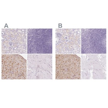 Anti-IGFBP1 antibody produced in rabbit Prestige Antibodies® Powered by Atlas Antibodies, affinity isolated antibody, buffered aqueous glycerol solution