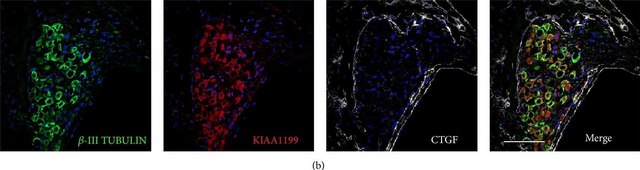 Monoclonal Anti-β-Tubulin III antibody produced in mouse clone SDL.3D10, ascites fluid