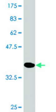 Monoclonal Anti-PYGM, (C-terminal) antibody produced in mouse clone 3D8, purified immunoglobulin, buffered aqueous solution