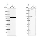 Anti-RPAP3 antibody produced in rabbit Prestige Antibodies&#174; Powered by Atlas Antibodies, affinity isolated antibody, buffered aqueous glycerol solution