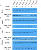 Anti-PP2A Antibody, C subunit, clone 1D6 clone 1D6, Upstate&#174;, from mouse