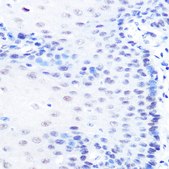 Anti-MITF antibody produced in rabbit
