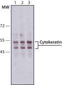 Monoclonal Anti-Cytokeratin, pan antibody produced in mouse clone PCK-26, ascites fluid