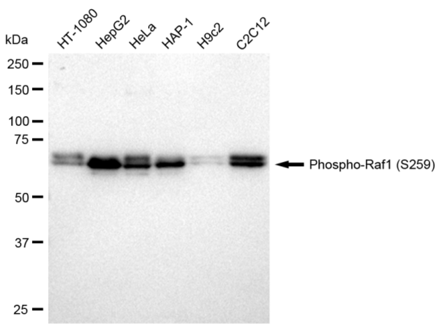 Anti-phospho-Raf1 (Ser259) Antibody, clone 23GB2645, Rabbit Monoclonal clone 23GB2645, recombinant rabbit monoclonal, expressed in HEK293 cells